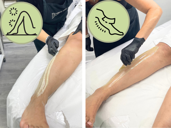 side by side view of a leg being sugared and waxed