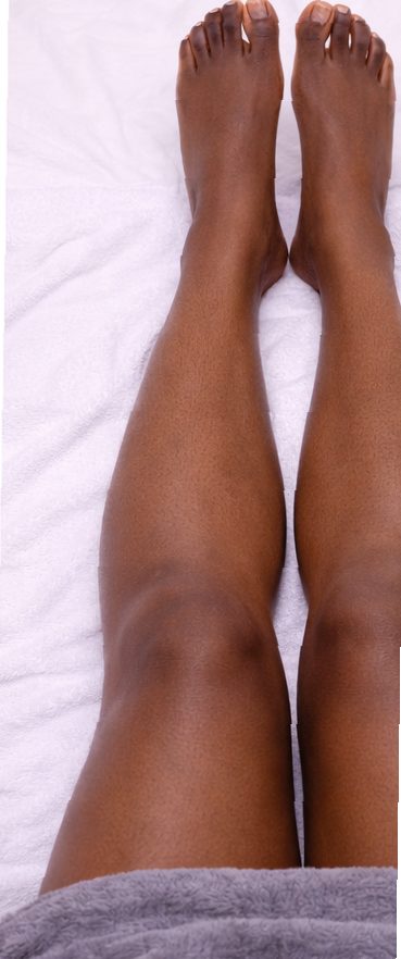 Before leg laser hair removal on dark skin showing visible lower leg hair
