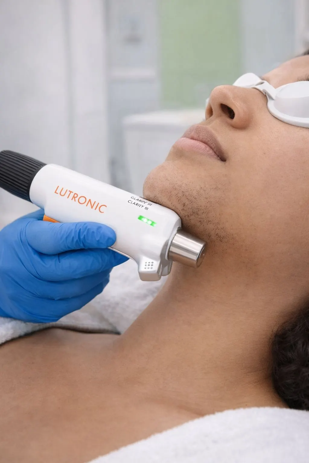 Laser hair removal consultation for PCOS-related facial hair at Aroma in Toronto
