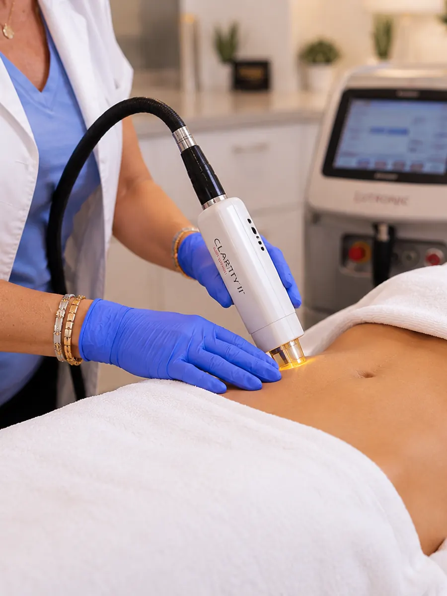 Chest and stomach laser hair removal treatment at Aroma Toronto